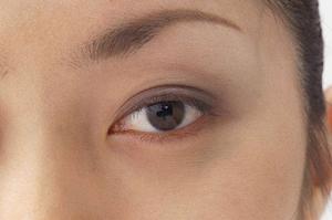 頻繁な頭痛は接骨院で治せる〜京都編〜